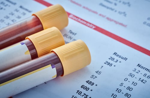 blood sample vials laying on top of test results